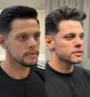 Harmonização facial em Fortaleza - Antes e depois.jpg
