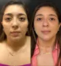 clínica de harmonização facial em Fortaleza 6.jpg