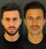 clínica de harmonização facial em Fortaleza.jpg