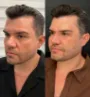 clínica de harmonização facial em Fortaleza 2.jpg