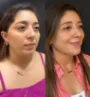 clínica de harmonização facial em Fortaleza 3.jpg
