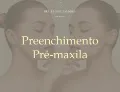 Preenchimento Pré-maxila