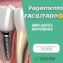 Implante e Protese Dental