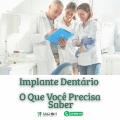 O que devo saber para fazer Implante Dentário em Arapongas