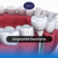 Zafinne Odontologia Dentista Porto Alegre Clínica Odontológica Implante Dentário