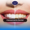 Zafinne Odontologia Dentista Porto Alegre Clínica Odontológica Implante Dentário