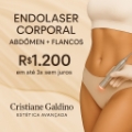 Endolaser corporal