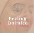 Peeling Químico para Renovação da Pele em Volta Redonda