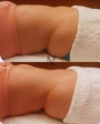 Miracle Touch Método Renata França