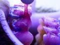 Clareamento dental em Fortaleza