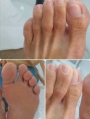 peeling-podal-duque-de-caxias