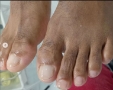 corte-correto-das-unhas