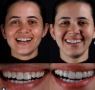 resultado