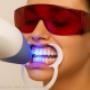 clareamento laser porto alegre