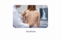 Tratamento da Escoliose