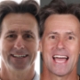 Antes e depois