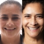 Antes e Depois