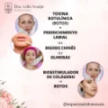 aplicação de botox São Luís-preenchimento labial fica natural-rinomodelação funciona mesmo-Espaço Sandra Souza- Estética Facial e Corporal