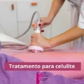 Tratamento para celulite em São Luís