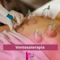Ventosaterapia de São Luís