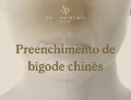 Preenchimento de bigode chinês em fortaleza