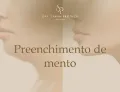 Preenchimento de mento em fortaleza