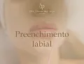 Preenchimento labial em fortaleza