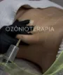 Ozonioterapia